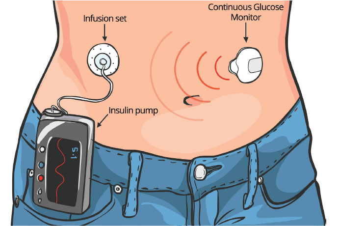 Introduction To Insulin Safety An Introduction For Everyone Metaverseskills 